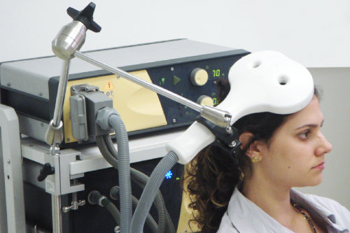 TMS therapy